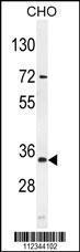 Anti-AKIP1 Rabbit Polyclonal Antibody (HRP (Horseradish Peroxidase))