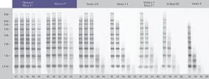 FERMEP0753 - MAXIMA H MINUS 4X10000 UNITS