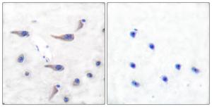 Immunohistochemical analysis of paraffin-embedded human brain using Anti-MARCKS (phospho Ser163) Antibody. The right hand panel represents a negative control, where the antibody was pre-incubated with the immunising peptide.