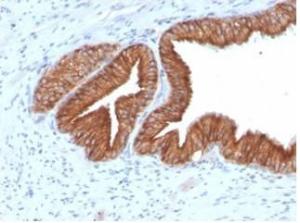 SDS-PAGE analysis of Anti-IGF1 Receptor Antibody [IGF1R/4667] under non-reduced and reduced conditions; showing intact IgG and intact heavy and light chains, respectively. SDS-PAGE analysis confirms the integrity and purity of the Antibody