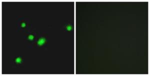 Immunofluorescence analysis of A549 cells using Anti-MUTYH Antibody. The right hand panel represents a negative control, where the antibody was pre-incubated with the immunising peptide.