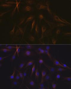 Immunofluorescence analysis of C6 cells using Anti-beta I Tubulin Antibody [ARC2484] (A305467) at a dilution of 1:100 (40x lens). DAPI was used to stain the cell nuclei (blue).