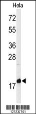 Anti-MMGT1 Rabbit Polyclonal Antibody