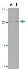 Anti-MANF Rabbit Polyclonal Antibody