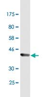 Anti-CTNNBL1 Mouse Monoclonal Antibody [clone: 5F1]