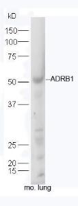 Anti-ADRB1 Rabbit Polyclonal Antibody