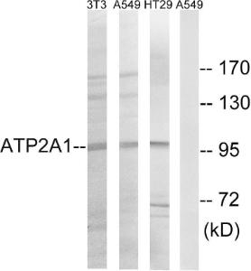 Western blot analysis of lysates from HT-29, A549, and NIH/3T3 cells using Anti-ATP2A1 Antibody. The right hand lane represents a negative control, where the Antibody is blocked by the immunising peptide