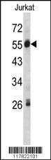 Anti-SERPING1 Rabbit Polyclonal Antibody