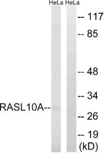 Western blot analysis of lysates from HeLa cells using Anti-RASL10A Antibody. The right hand lane represents a negative control, where the antibody is blocked by the immunising peptide