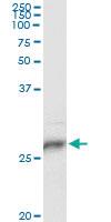 Anti-HLA-DPB1 Mouse Monoclonal Antibody