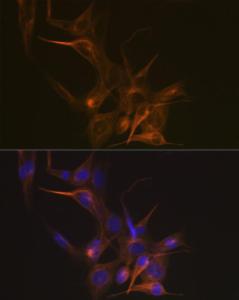 Immunofluorescence analysis of NIH-3T3 cells using Anti-beta I Tubulin Antibody [ARC2484] (A305467) at a dilution of 1:100 (40x lens). DAPI was used to stain the cell nuclei (blue).