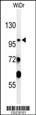 Anti-INPP5F Rabbit Polyclonal Antibody