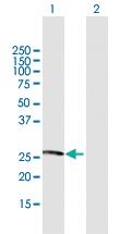 Anti-NXNL1 Mouse Polyclonal Antibody