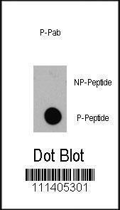 Anti-EIF4EBP1 Rabbit Polyclonal Antibody (Biotin)