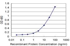 Anti-ID1 Mouse Monoclonal Antibody [clone: 4F6]