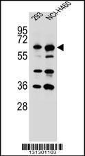 Anti-CKAP4 Rabbit Polyclonal Antibody (Biotin)