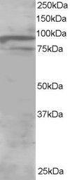 Anti-OSBPL11 antibody