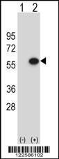 Anti-ERGIC3 Rabbit Polyclonal Antibody (AP (Alkaline Phosphatase))