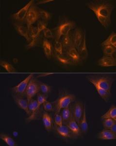 Immunofluorescence analysis of U-2 OS cells using Anti-beta I Tubulin Antibody [ARC2484] (A305467) at a dilution of 1:100 (40x lens). DAPI was used to stain the cell nuclei (blue).