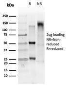 SDS-PAGE analysis of Anti-GTF2IRD2 Antibody [PCRP-GTF2IRD2-1B4] under non-reduced and reduced conditions; showing intact IgG and intact heavy and light chains, respectively. SDS-PAGE analysis confirms the integrity and purity of the Antibody