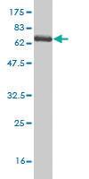 Anti-SPHK1 Mouse Monoclonal Antibody [clone: 1D6]