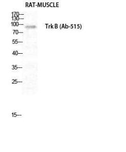 Anti-TrkB Rabbit Polyclonal Antibody