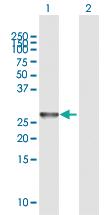 Anti-NXNL1 Rabbit Polyclonal Antibody