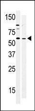 Anti-PTK6 Rabbit Polyclonal Antibody (FITC (Fluorescein))