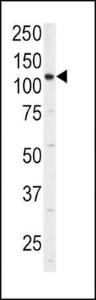 Anti-ITGA6, Isoform 2 Rabbit Polyclonal Antibody (AP (Alkaline Phosphatase))