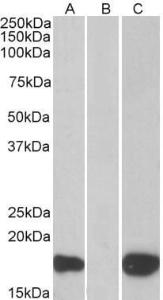 HEK293 lysate (10ug protein in RIPA buffer) overexpressing Human PHLDA3 with C-terminal MYC tag probed with Anti-PHLDA3 Antibody (A83982)