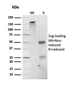 SDS-PAGE analysis of Anti-PSMD4 Antibody [CPTC-PSMD4-3] under non-reduced and reduced conditions; showing intact IgG and intact heavy and light chains, respectively. SDS-PAGE analysis confirms the integrity and purity of the antibody