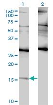 Anti-ID2H Mouse Monoclonal Antibody [clone: 3C3]