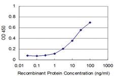 Anti-GDF7 Mouse Monoclonal Antibody [clone: 4F10]