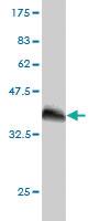 Anti-BPNT1 Mouse Monoclonal Antibody [clone: 2E1]