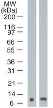 Anti-S100A7 Mouse Monoclonal Antibody [clone: 47C1068]