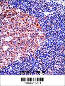 Anti-MCM4 Rabbit Polyclonal Antibody