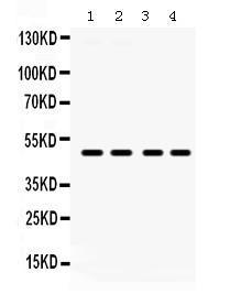 Anti-F2RL1 Rabbit Polyclonal Antibody