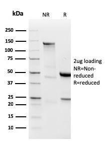 SDS-PAGE analysis of Anti-Lambda Light Chain Antibody [LLC/3778R] under non-reduced and reduced conditions; showing intact IgG and intact heavy and light chains, respectively. SDS-PAGE analysis confirms the integrity and purity of the antibody