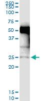 Anti-NXNL1 Rabbit Polyclonal Antibody