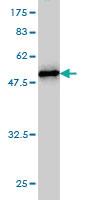 Anti-NOP16 Mouse Monoclonal Antibody [clone: 1G4]