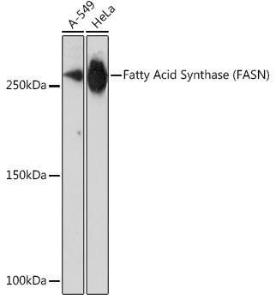 Western blot analysis of extracts of various cell lines, using Anti-Fatty Acid Synthase Antibody [ARC0377] (A305468) at 1:1000 dilution. The secondary Antibody was Goat Anti-Rabbit IgG H&L Antibody (HRP) at 1:10000 dilution.