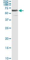 Anti-PHGDH Antibody Pair