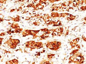 Anti-S100A7 Mouse Monoclonal Antibody [clone: 47C1068]