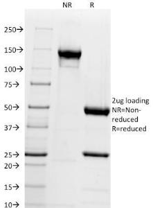 SDS-PAGE analysis of Anti-Chromogranin A Antibody [CGA/414] under non-reduced and reduced conditions; showing intact IgG and intact heavy and light chains, respectively. SDS-PAGE analysis confirms the integrity and purity of the Antibody