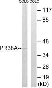 Western blot analysis of lysates from COLO cells using Anti-PRPF38A Antibody. The right hand lane represents a negative control, where the antibody is blocked by the immunising peptide.