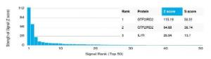 Analysis of protein array containing more than 19000 full-length human proteins using Anti-GTF2IRD2 Antibody [PCRP-GTF2IRD2-1B4]