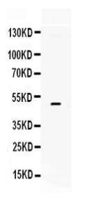 Anti-F3 Rabbit Polyclonal Antibody