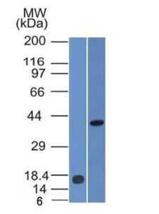 Western blot analysis of (Lane 1) recombinant PAX2 protein fragment and (Lane 2) human kidney tissue lysate using Anti-PAX2 Antibody [PAX2/1105]