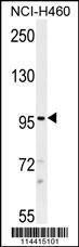 Western blot analysis in NCI-H460 cell line lysates (35 µg/lane)