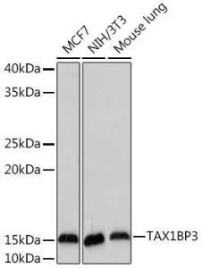 Western blot analysis of extracts of various cell lines, using Anti-TIP-1 Antibody [ARC2319] (A307891) at 1:1,000 dilution. The secondary antibody was Goat Anti-Rabbit IgG H&L Antibody (HRP) at 1:10,000 dilution.